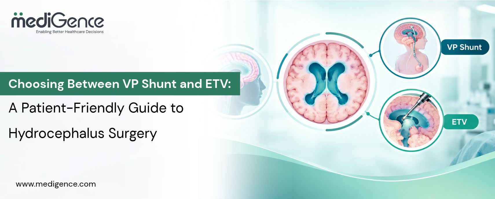 Choosing Between VP Shunt and ETV: A Patient-Friendly Guide to Hydrocephalus Surgery